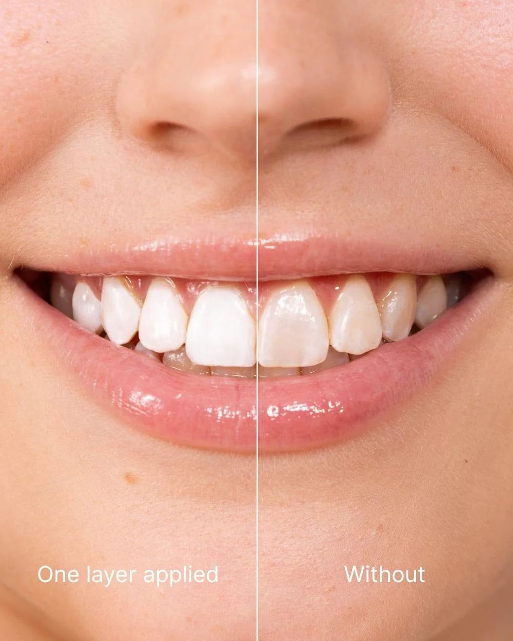 NESLEMY® Tooth Polish - Instant White Smile
