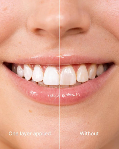 NESLEMY® Tooth Polish - Instant White Smile