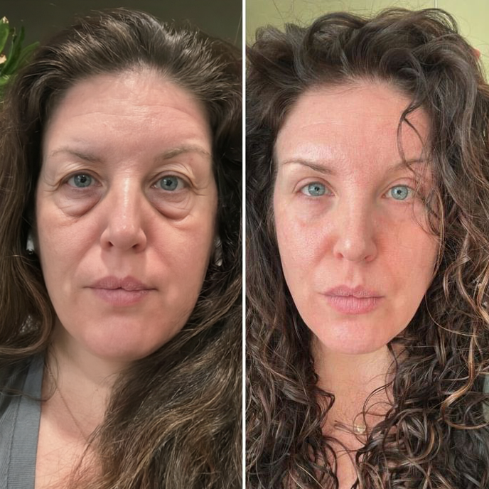 ChewRoutine customer before and after result