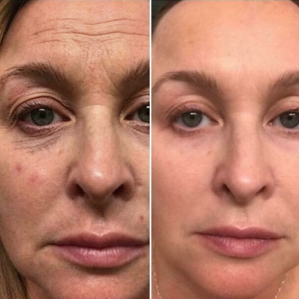 ChewRoutine under-eye customer result