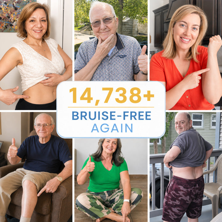 🔥100K+ Customers Served – ChewRoutine® Arnica Bruise Cream